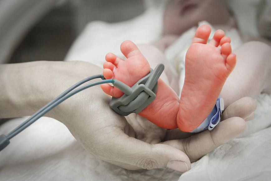 Photo Of Newborn's Feet With Attached Monitor