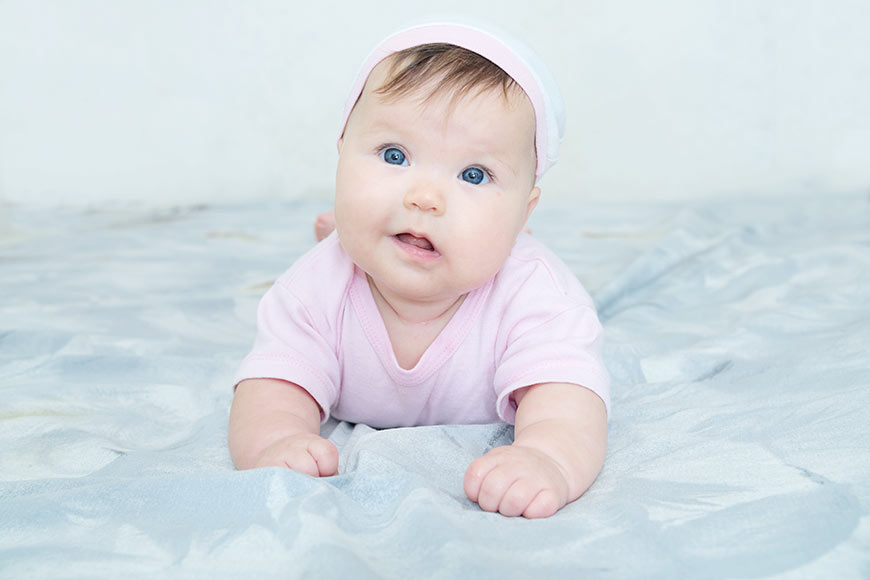 Photo of a baby girl with Torticollis